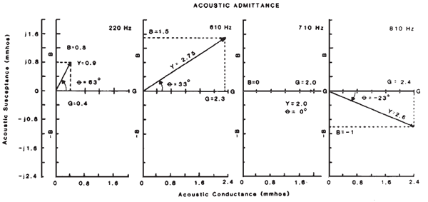 A diagram for plotting findings for tympanometry and acoustic